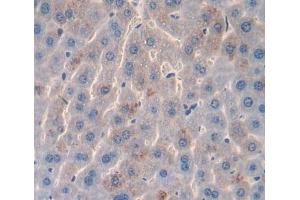 Used in DAB staining on fromalin fixed paraffin- embedded liver tissue (AADAT anticorps  (AA 99-425))