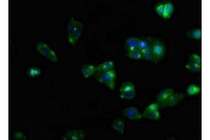 Immunofluorescent analysis of HepG2 cells using ABIN7146111 at dilution of 1:100 and Alexa Fluor 488-congugated AffiniPure Goat Anti-Rabbit IgG(H+L)