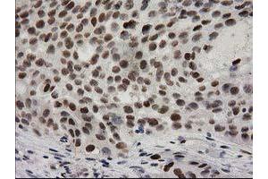 Image no. 13 for anti-Protein Kinase C, epsilon (PRKCE) antibody (ABIN1500229)