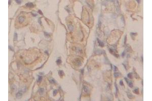 Detection of ACTG in Human Stomach Tissue using Polyclonal Antibody to Gamma Actin (ACTG)