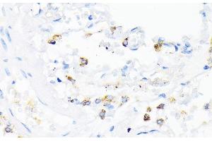 Immunohistochemistry of paraffin-embedded Human lung using CAMP Polyclonal Antibody at dilution of 1:200 (40x lens). (Cathelicidin anticorps)