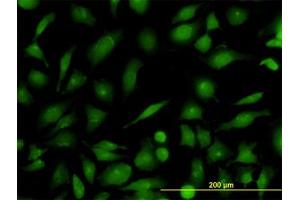 Image no. 3 for anti-RAB21, Member RAS Oncogene Family (RAB21) (AA 116-226) antibody (ABIN599189) (RAB21 anticorps  (AA 116-226))