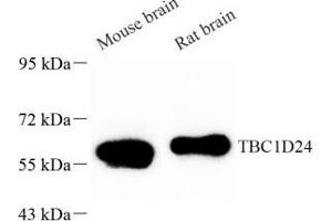 Western blot analysis of TBC1D24 (ABIN7075847) at dilution of 1: 1000