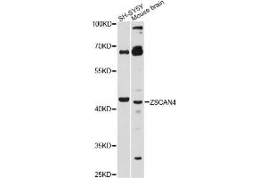 Western blot analysis of extracts of various cell lines, using ZSCAN4 antibody. (ZSCAN4 anticorps)