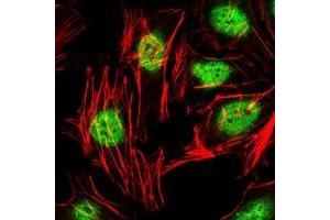 Immunofluorescence analysis of Hela cells using ZBTB16 antibody (green). (ZBTB16 anticorps)