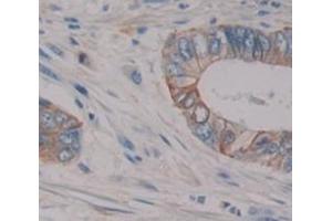 IHC-P analysis of Human Tissue, with DAB staining. (Oncostatin M Receptor anticorps  (AA 513-760))