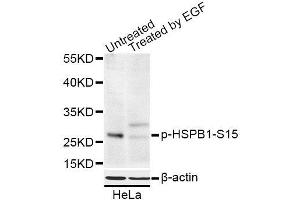 Western blot analysis of extracts of HeLa cells, using Phospho-HSPB1-S15 antibody (ABIN5969897) at 1/1000 dilution. (HSP27 anticorps  (pSer15))