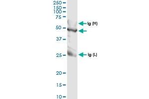 Immunoprecipitation of TALDO1 transfected lysate using anti-TALDO1 MaxPab rabbit polyclonal antibody and Protein A Magnetic Bead , and immunoblotted with TALDO1 MaxPab rabbit polyclonal antibody (D01) . (TALDO1 anticorps  (AA 1-337))