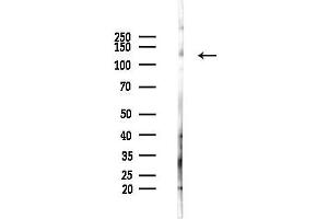 Western blot analysis of lysates from Mouse liver, using ADNP Antibody at 1/1000 dilution.