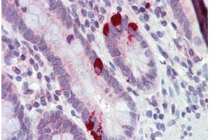 Human Small Intestine (formalin-fixed, paraffin-embedded) stained with SLC39A5 antibody ABIN462243 followed by biotinylated goat anti-rabbit IgG secondary antibody ABIN481713, alkaline phosphatase-streptavidin and chromogen.