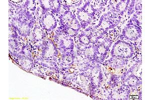 Formalin-fixed and paraffin embedded rat colitis labeled with Anti-IL-12 Polyclonal Antibody, Unconjugated (ABIN672951) at 1:200, followed by conjugation to the secondary antibody and DAB staining (IL12A anticorps  (AA 51-150))