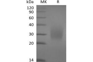 Western Blotting (WB) image for B-cell antigen receptor complex-associated protein alpha chain (CD79A) protein (His tag) (ABIN7319899)