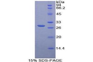 SDS-PAGE analysis of Human PTPRM Protein. (PTPRM Protéine)