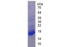 SDS-PAGE of Protein Standard from the Kit  (Highly purified E. (PRO-ANP Kit ELISA)