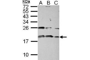 WB Image Sample (30 ug of whole cell lysate) A: PC-3 B: U87-MG C: SK-N-SH 15% SDS PAGE antibody diluted at 1:1000 (IGF1 anticorps)