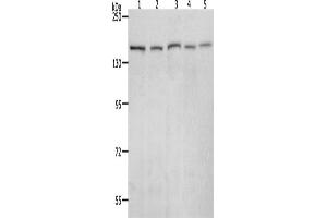 Western Blotting (WB) image for anti-RAD50 Homolog (S. Cerevisiae) (RAD50) antibody (ABIN2426374) (RAD50 anticorps)