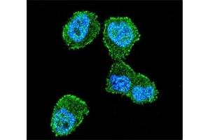 Confocal immunofluorescent analysis of LKB1 antibody with ZR-75-1 cells followed by Alexa Fluor 488-conjugated goat anti-rabbit lgG (green).