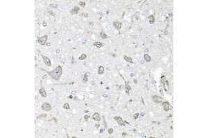 Immunohistochemistry of paraffin-embedded rat brain using FGF1 antibody at dilution of 1:100 (x40 lens). (FGF1 anticorps)