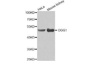 Western blot analysis of extracts of various cell lines, using OGG1 antibody(1:200). (OGG1 anticorps)