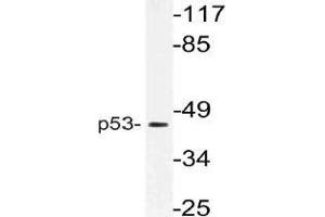 Western blot (WB) analysis of p53 antibody in extracts from HT-29 cells. (p53 anticorps)