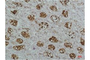 Immunohistochemical analysis of paraffin-embedded Human Kidney Tissue using IκB βMouse mAb diluted at 1:200. (NFKBIB anticorps)