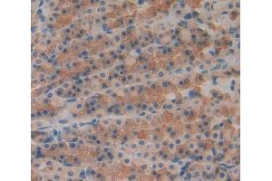 IHC-P analysis of stomach tissue, with DAB staining. (RIPK1 anticorps  (AA 1-179))