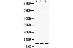 Western blot analysis of MPS1 expression in rat spleen extract ( Lane 1), mouse liver extract ( Lane 2) and HELA whole cell lysates ( Lane 3). (RPS27 anticorps  (AA 2-84))