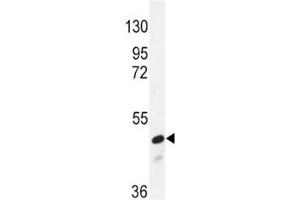 Western blot analysis of SMAD2 antibody and NIH3T3 lysate.