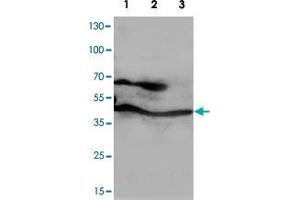 Western blot analysis of whole cell lysates with PPID polyclonal antibody . (PPID anticorps  (C-Term))