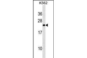 NOP16 Antibody (C-term) (ABIN1536695 and ABIN2850316) western blot analysis in K562 cell line lysates (35 μg/lane).