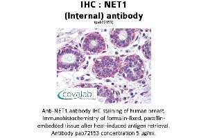 Image no. 1 for anti-Neuroepithelial Cell Transforming 1 (NET1) (Internal Region) antibody (ABIN1737274) (NET1 anticorps  (Internal Region))