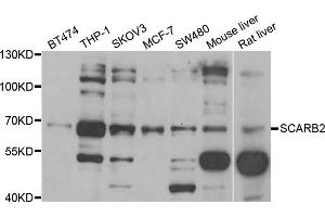 Western blot analysis of extracts of various cell lines, using SCARB2 antibody (ABIN5973710) at 1/1000 dilution. (SCARB2 anticorps)