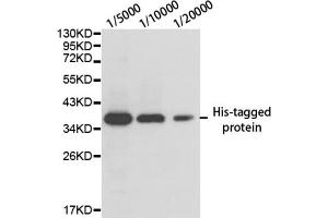 Image no. 3 for anti-His Tag antibody (ABIN2970881) (His Tag anticorps)