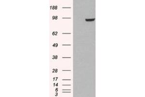 Western Blotting (WB) image for anti-phosphodiesterase 5A, cGMP-Specific (PDE5A) (C-Term) antibody (ABIN2466086) (PDE5A anticorps  (C-Term))