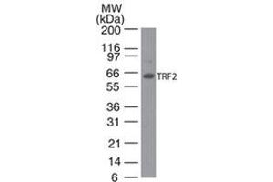 TRF2 Western Blot.