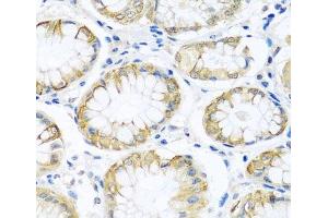 Immunohistochemistry of paraffin-embedded Human stomach using PCDHA12 Polyclonal Antibody at dilution of 1:100 (40x lens). (PCDHA12 anticorps)