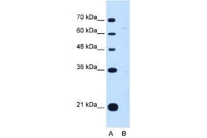 DONSON antibody used at 1 ug/ml to detect target protein. (DONSON anticorps  (Middle Region))