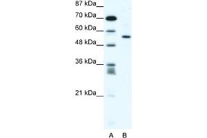 WB Suggested Anti-RUNX2 Antibody Titration:  1. (RUNX2 anticorps  (Middle Region))