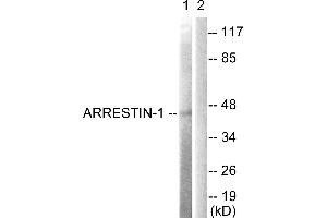 Immunohistochemistry analysis of paraffin-embedded human brain tissue using Arrestin 1 (Ab-412) antibody. (SAG anticorps  (Ser412))