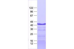Validation with Western Blot (ZIM3 Protein (His tag))