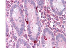 EEF2 antibody was used for immunohistochemistry at a concentration of 4-8 ug/ml.