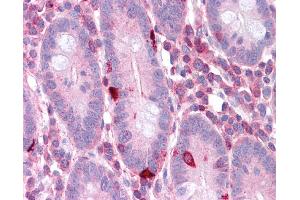 EEF2 antibody was used for immunohistochemistry at a concentration of 4-8 ug/ml. (EEF2 anticorps  (N-Term))