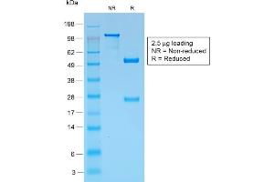 SDS-PAGE Analysis Purified gp100 Rabbit Recombinant Monoclonal Antibody (PMEL/1825R).