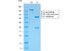 SDS-PAGE Analysis Purified gp100 Rabbit Recombinant Monoclonal Antibody (PMEL/1825R). (Recombinant Melanoma gp100 anticorps)