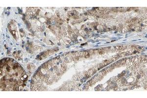 ABIN6273398 at 1/100 staining Human prostate tissue by IHC-P.