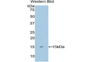 Western Blotting (WB) image for anti-Keratin 2 (KRT2) (AA 7-160) antibody (ABIN1859577)