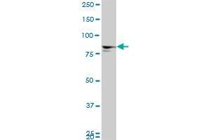 MTA1 monoclonal antibody (M01), clone 4D5.