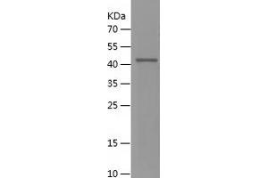 Western Blotting (WB) image for Synovial Sarcoma, X Breakpoint 4 (SSX4) (AA 1-188) protein (His-IF2DI Tag) (ABIN7125287)