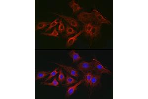 Immunofluorescence analysis of C6 cells using α-Tubulin Mouse mAb (ABIN7271035) at dilution of 1:100 (40x lens). (TUBA4A anticorps)