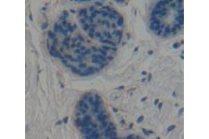 IHC-P analysis of Human Tissue, with DAB staining. (CNN1 anticorps  (AA 1-268))
